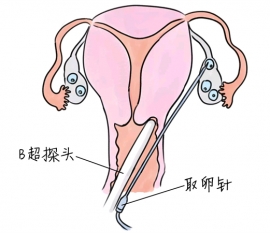 幼儿学画画，济南捐卵宝宝学画画，学画画的好处，如何学画画
