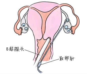 幼儿学画画，济南捐卵宝宝学画画，学画画的好处，如何学画画